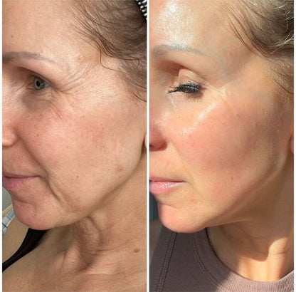 ProtoCol™ Colageno 10 en 1